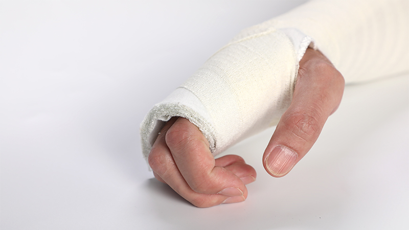 医用高分子夹板