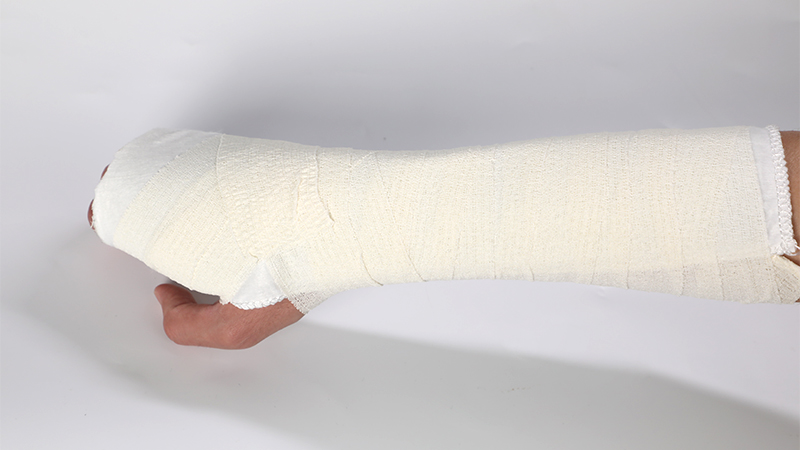 医用高分子夹板